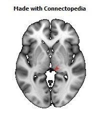 Corticospinal_tract_R108