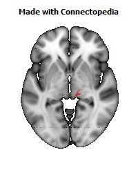 Corticospinal_tract_R110