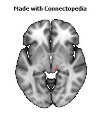 Corticospinal_tract_R112