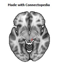 Corticospinal_tract_R116