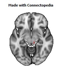 Corticospinal_tract_R118