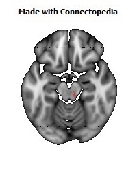 Corticospinal_tract_R124