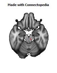 Corticospinal_tract_R128