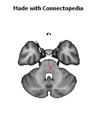 Corticospinal_tract_R140