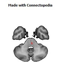 Corticospinal_tract_R144