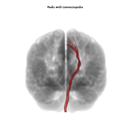 Cortico-Spinal Tract