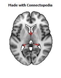 Fornix102