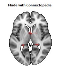 Fornix104