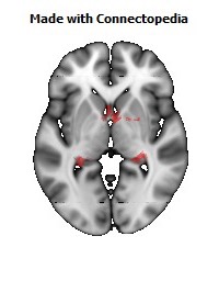 Fornix108