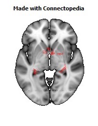 Fornix110