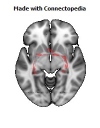 Fornix114