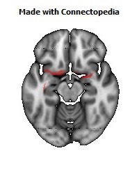 Fornix122