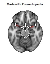 Fornix124