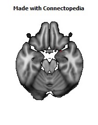 Fornix128