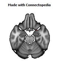 Fornix130