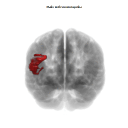 Inferior Fronto-Opercular Gyrus