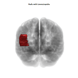 Frontal Inferior Gyrus