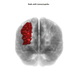 Middle Frontal Gyrus