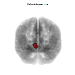Middle Pre-Fronto-Orbital Gyrus