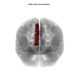Medial Frontal Superior Gyrus