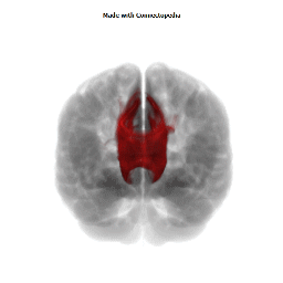 Genu of Corpus Callosum