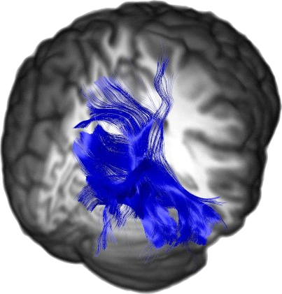 Posterior Thalamic Radiations