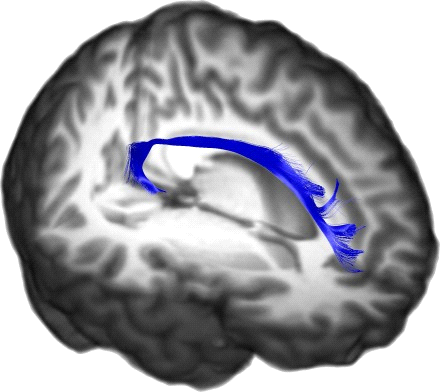 Cingular (Cingulum) Fasciculus