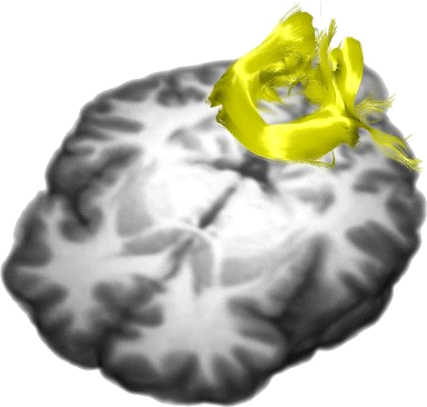 Splenium of Corpus Callosum