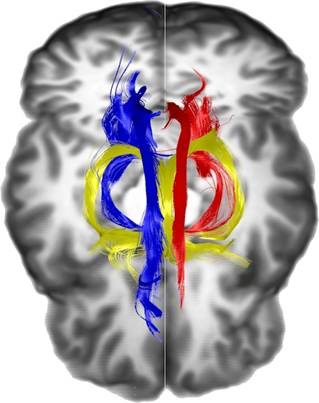 Limbic System Bundles