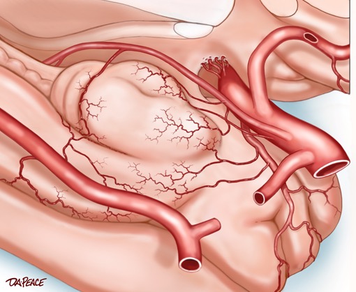 Uncal Artery