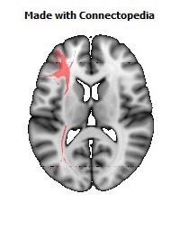 Inferior_Fronto_Occipital_L094