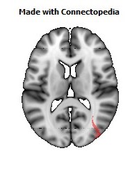 Inferior_Longitudinal_L094