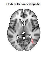 Inferior_Longitudinal_L102