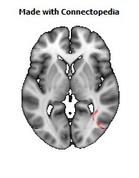 Inferior_Longitudinal_L106