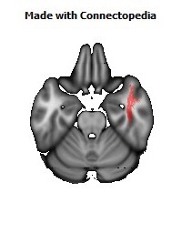 Inferior_Longitudinal_L132