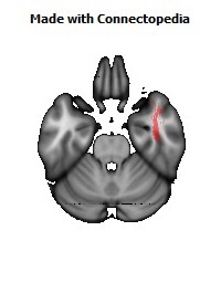 Inferior_Longitudinal_L134