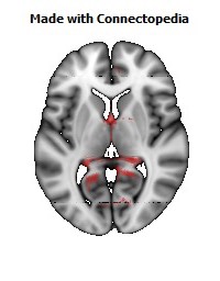 Limbic_System102