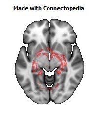 Limbic_System114