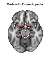 Limbic_System122