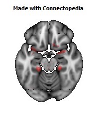 Limbic_System124