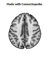 Medial_lemniscus_R066