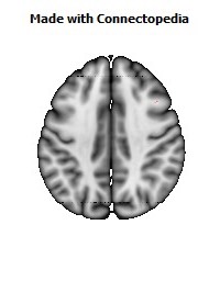 Medial_lemniscus_R068