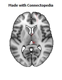 Medial_lemniscus_R100