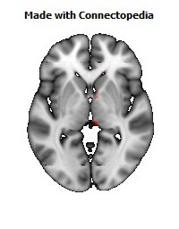 Medial_lemniscus_R108