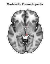 Medial_lemniscus_R112