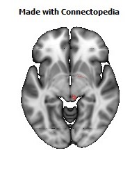 Medial_lemniscus_R114