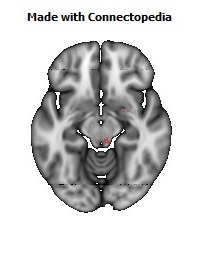 Medial_lemniscus_R120