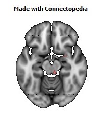 Medial_lemniscus_R122