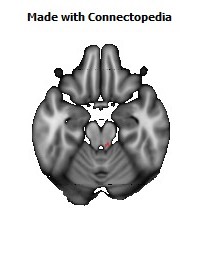 Medial_lemniscus_R128