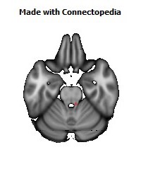 Medial_lemniscus_R132